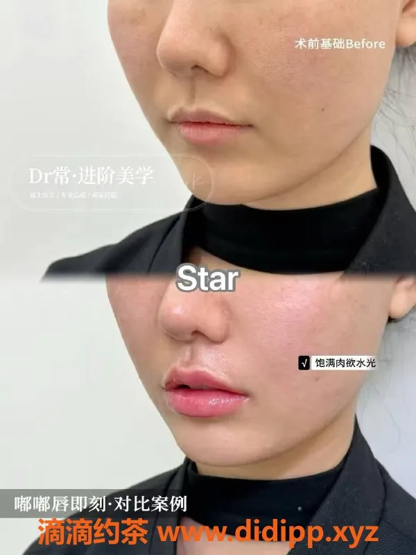 广州楼凤-广州瘦身与美容服务，专业注射提升体验