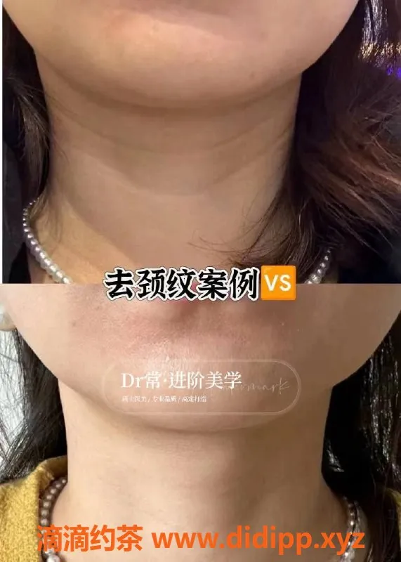 广州楼凤-广州瘦身与美容服务，专业注射提升体验