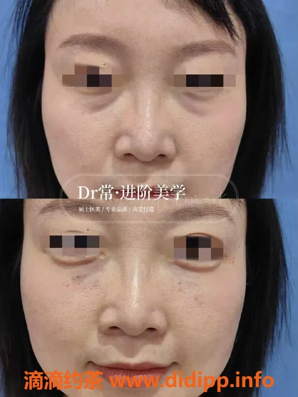 广州楼凤-广州瘦身与美容服务，专业注射提升体验