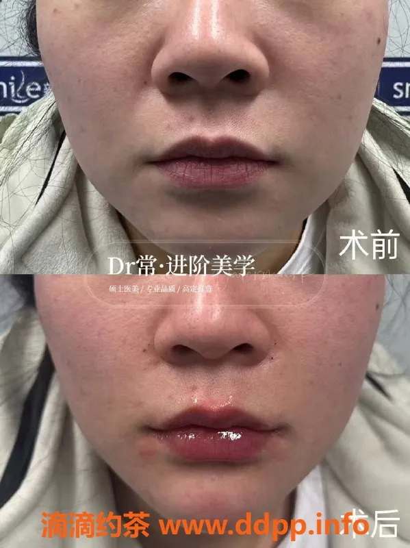 广州楼凤资源信息,广州瘦身与美容服务，专业注射提升体验