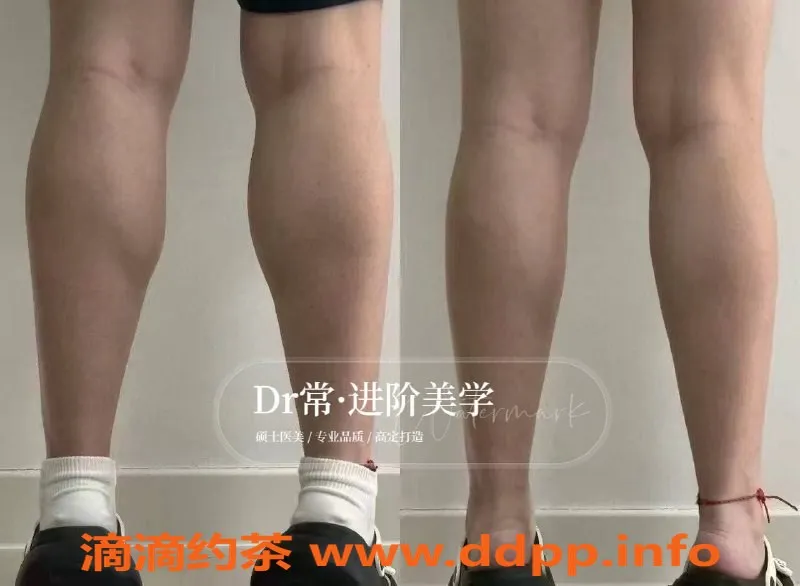 广州楼凤-广州瘦身与美容服务，专业注射提升体验