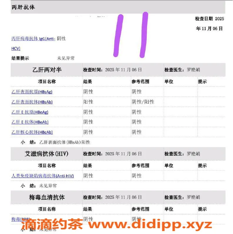 深圳楼凤-福田兼职美女木木💕 166cm 57kg 纯天然服务